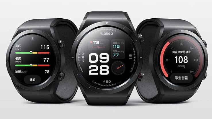 Next-gen Xiaomi Watch emerges with monster battery upgrade and eSIM in new leak