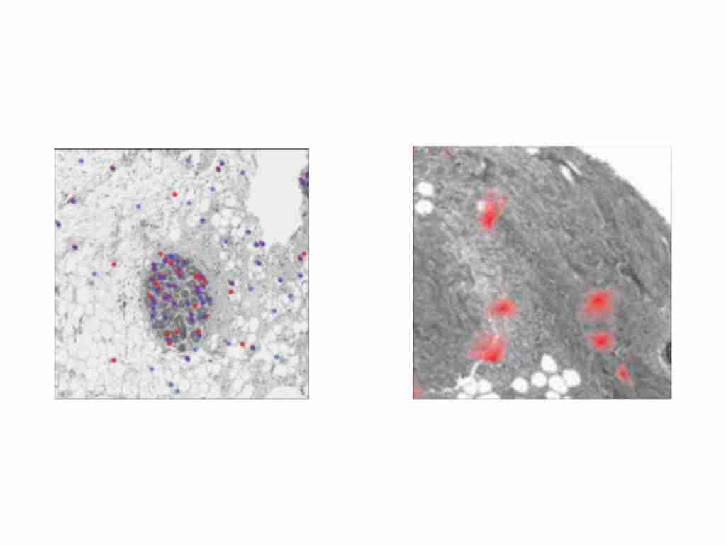 New groundbreaking AI deep learning model is nearly five times better at predicting breast cancer risk than traditional ones