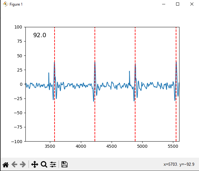 Simple DIY HR Monitor ECG Display